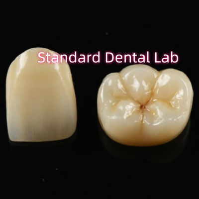 วัสดุที่เข้ากันได้ทางชีวภาพ สวยงาม Zirconia Crown Zirconia Bridge Teeth