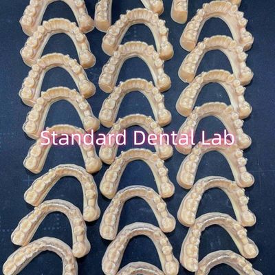 โปรแกรมการรักษาทันตแพทย์มืออาชีพ Orthodontic Invisalign