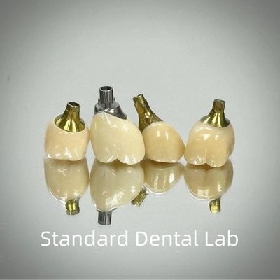 โปรเฟชั่นเซอร์โคเนีย สกรูยึดตัวประกอบการ หมึกไทเทเนียม CAD CAM