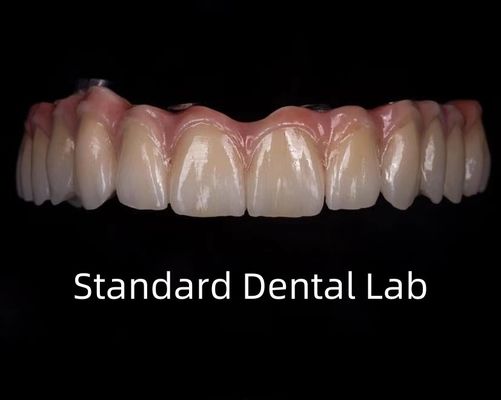 ทิตาเนียมครบ Zirconia Bridge ทันตรอันตรายบนแท่งการปลูก