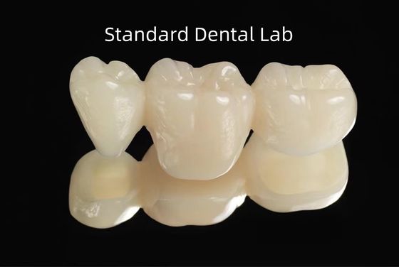 CAD CAM PMMA ข้างว่าง สะพานทันตชั่วคราวชั่วคราว