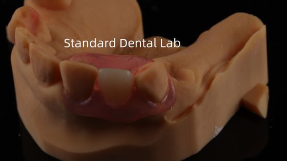 ทันตแพทย์ TCS Valplast ฟักฟันส่วนยืดหยุ่น Nesbit Valplast จบ จีน ทันตแพทย์ Lab Valplast จับ