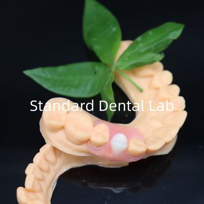 ฟันเทียมยืดหยุ่นเอสเทติกวาลพลาสต์ พร้อมประกันการเปลี่ยนฟันฟรีใน 3 วัน China Dental Lab