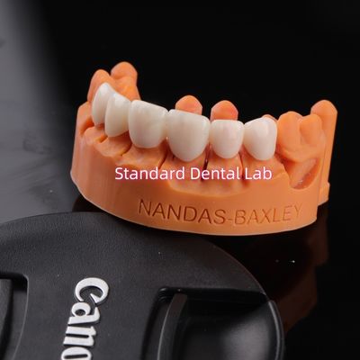 ความสะดวกสบายและการทํางานกับ Digital CAD CAM Dental Lab สะพานซิกโคนย่าชั้นใส