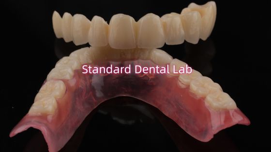 โปรเซลีนชั้นมีความทนทานสูงและดูธรรมชาติ สําหรับฟันชั้น Zirconia Crown China Dental Lab