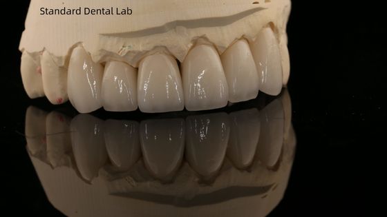 ครอบคลุมครอบคลุมครอบคลุม Zirconia และสะพานสีฟันธรรมชาติ 5 ปีรับประกัน