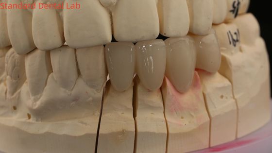 ตราห้องปฏิบัติการฟันแข็ง 3D โปร ใสสูง ตราซิกโอนีย์เต็ม