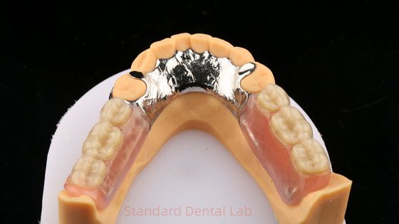 โลหะเหล็ก โคบัลต โครม โปรเทชั่นบางส่วน Ivoclar Scheftner สบาย โลหะเหล็กหลอม Framewrok