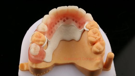 Peek Partional Frame Design ISO CE And FDA แผ่นปฏิบัติการทันตกรรม
