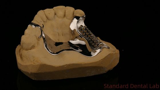 โครงสร้างพิมพ์ 3D ความแข็งแรงสูง COCR ฟันเทียมบางส่วน โครม โคบอลท์ โครงสร้างโลหะพิมพ์