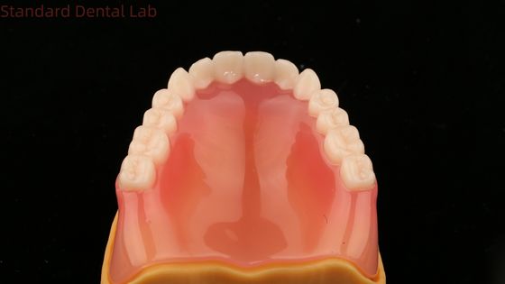 ฟันเทียมเต็ม Ivoclar ฟันเทียมเต็ม Acrylic ฟัน SDL ห้องทดลองฟัน