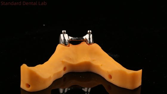 Ivoclar Digital Dental Implant Bar Prothesis with Attachments ปริมาณฟันที่ติดตั้งด้วยปริมาณฟันเต็มแบบอะคริลิกไทเทเนียม