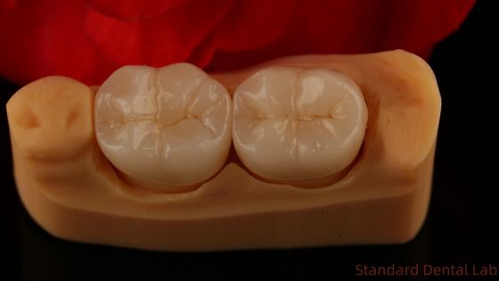 ครอบคลุมครอบคลุม Zirconia Crown ความแข็งแรงและความสวยงามอย่างพิเศษ ไม่มีการเคลือบโปรเซลิน