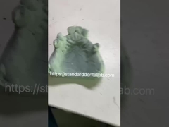 รากงาน Fast and Cast Co-Cr Metal Partional Denture Framework สําหรับนักทันตแพทย์