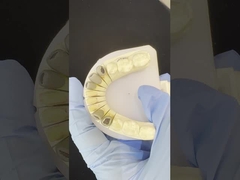 โลหะ Cast Post Core Crown Cocr เรตติเวฟแม่นยํา ครบ Zirconia Bruxier