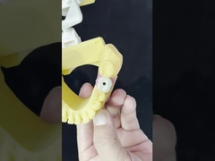 โปรเซลีน All On Four สะพานซิกอร์คอนียา ความสวยงามสูง สะพานปลูกฟัน