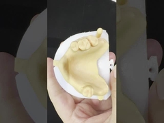 โลหะสลักส่วนหนึ่ง โคบาลต์ โครม ฟันเทียม Ivoclar Scheftner สบาย โลหะ Framewrok