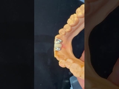 ฟันฟันฟันฟันฟันฟันฟันฟันฟันฟันฟันฟันฟันฟันฟันฟันฟันฟันฟันฟันฟันฟันฟันฟันฟันฟันฟันฟันฟันฟันฟันฟันฟันฟันฟันฟันฟันฟันฟันฟันฟันฟันฟันฟันฟันฟันฟันฟันฟันฟันฟันฟันฟันฟันฟันฟันฟันฟันฟันฟันฟันฟันฟันฟันฟันฟันฟันฟันฟันฟันฟันฟันฟันฟันฟันฟันฟันฟันฟันฟันฟันฟันฟันฟันฟัน