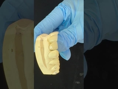 ครบวงจร Zirconia Crown/High Aesthetic Natural Customized Aidite Zirconia Dental Bridge สายฟันสีซิกโอนี