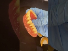 ฟันเทียมครบบนและล่าง อะคริลิคฟันเทียมส่วนหนึ่ง ฟัน Ivoclar ยําสีชมพู